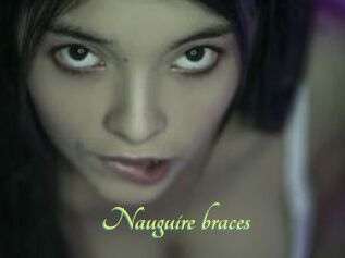 Nauguire_braces